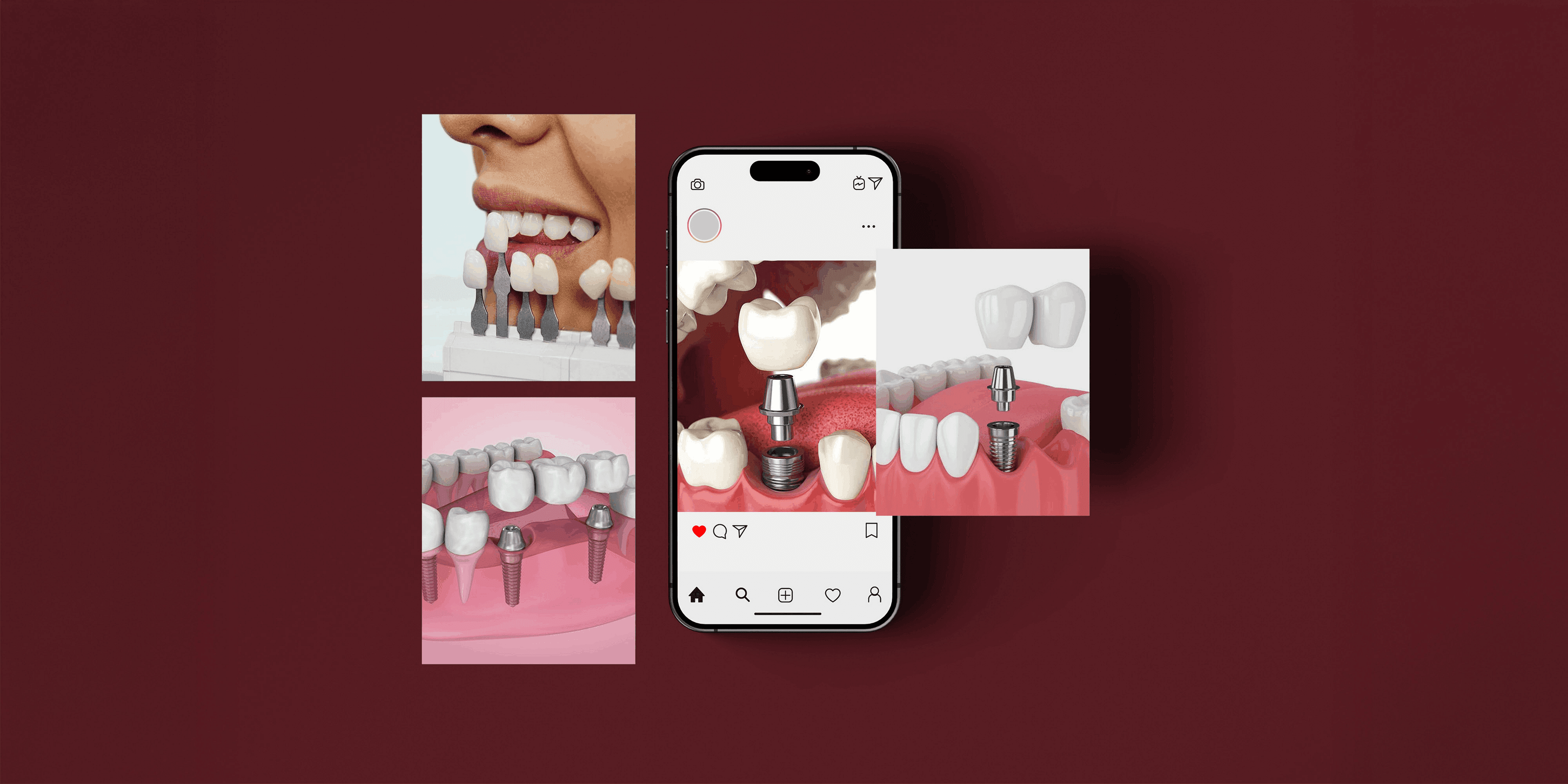 Zirkona Branding visual 13